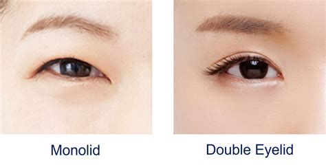 Monolids VS. Double Eyelids